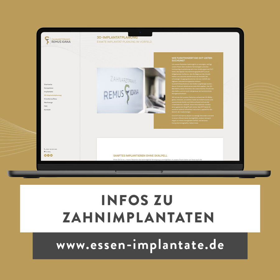 Zahnimplantate in Essen